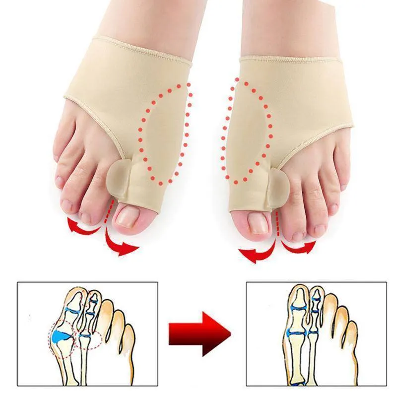 Miracle Bunion Corrector (2 pieces)